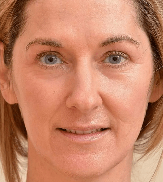 Eudalie kremini uyguladıktan sonra daha genç görünüyorum