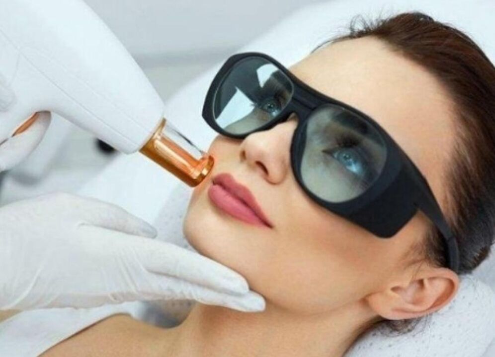 Cildin yüz gençleştirilmesi