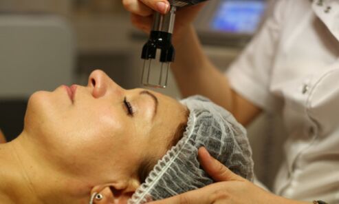 gençleştirme için fraksiyonel termoliz